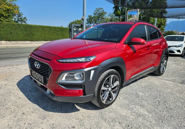 Zunanja slika - Hyundai Kona - 1.0 T-GDI Impression 1.LASTNIK SLO NAVI KAMERA ... - 1